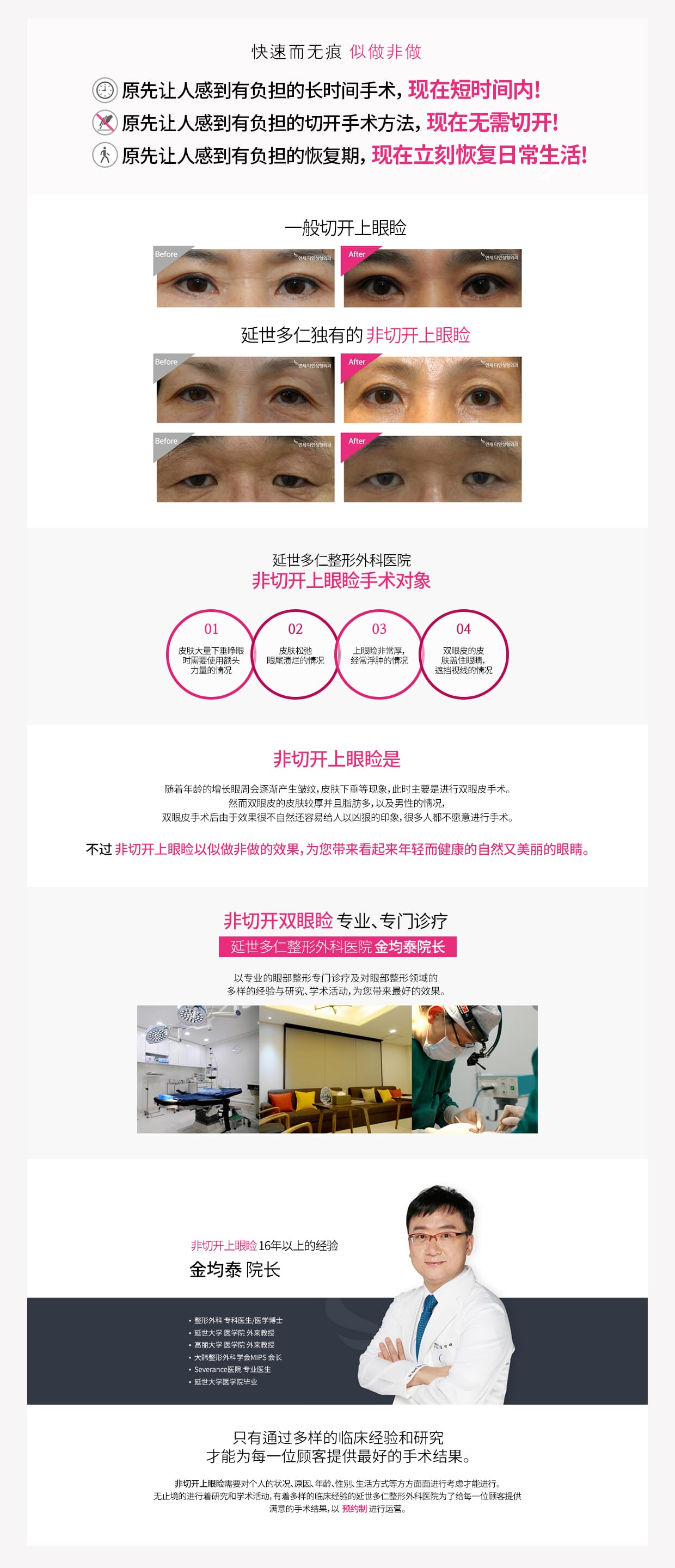 동안눈수술02