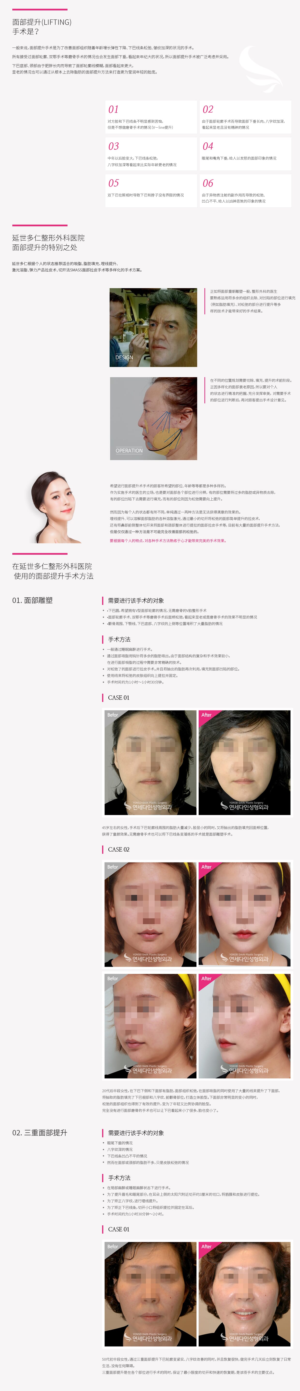 리프팅